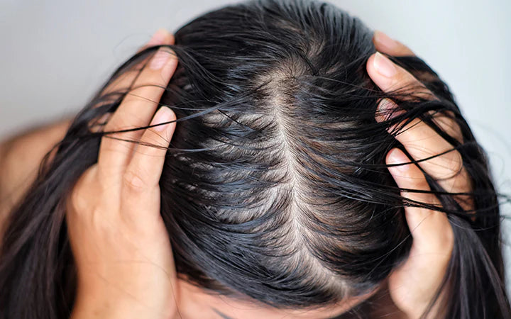 lady scratching her oily scalp with frustration