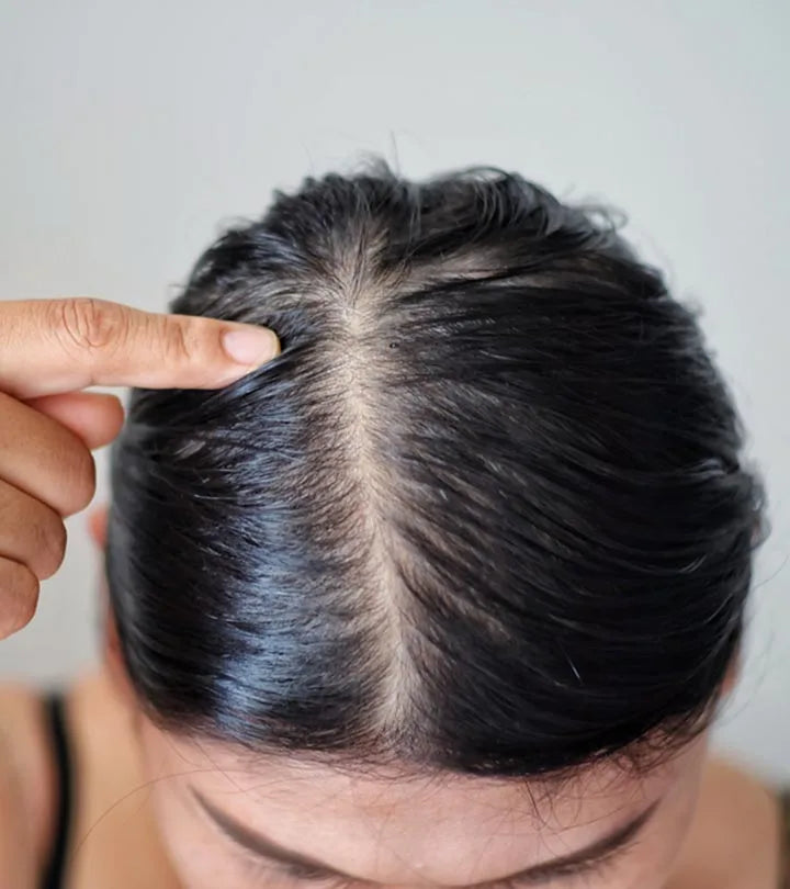 lady scratching her oily scalp with frustration