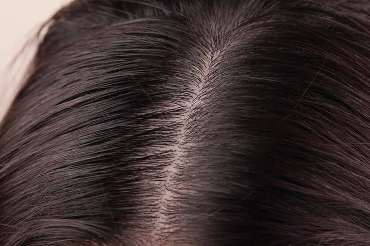 close up of scalp