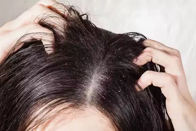 lady scratching her scalp close up