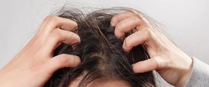 person scratching scalp